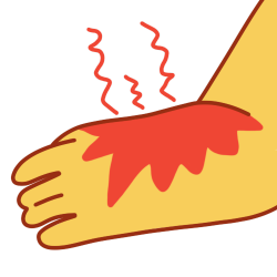 An arm with a red mark on the lower part and red zigzags radiating from the area